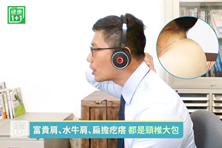 頸後凸一個大包?4個動作舒緩水牛肩