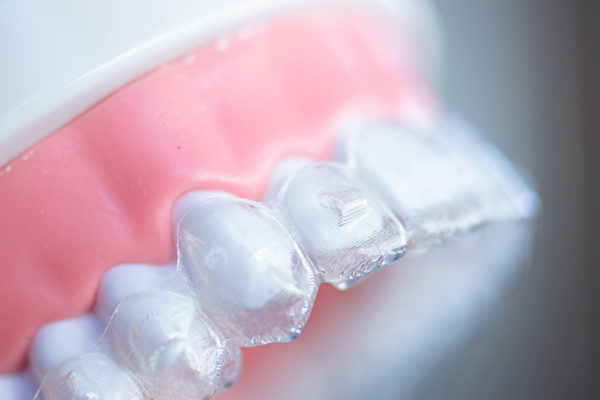 做牙齿矫正有哪些好处？(Shutterstock)