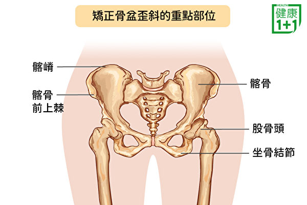 矫正骨盆歪斜的重点部位，包括髂骨、髂嵴、髂骨前上棘等。（健康1+1／大纪元）