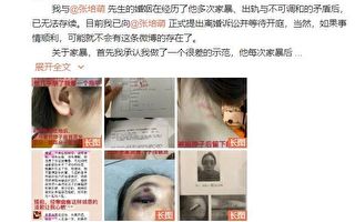 殴打岳母 中国短跑名将张培萌被拘留