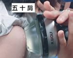 苗醫引進新型體外震波設備 疼痛患者福音