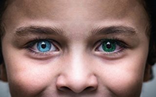 美国母子患罕见眼疾 瞳孔呈双色异常美丽