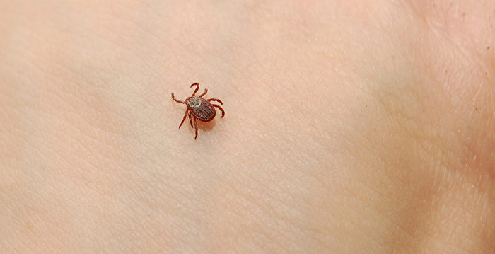 河南3人因患蜱虫病离世 曾与去世感染者接触