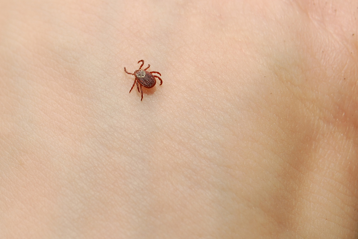 女子多次过敏险致命竟是因为曾被蜱虫叮咬| 牛肉| 孤星蜱虫| 大紀元, image size:1200x800