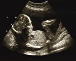 墮胎到底牽扯到哪些方面的問題？對女性的健康有什麼樣的傷害嗎？政府該怎麼做？(Shutterstock)