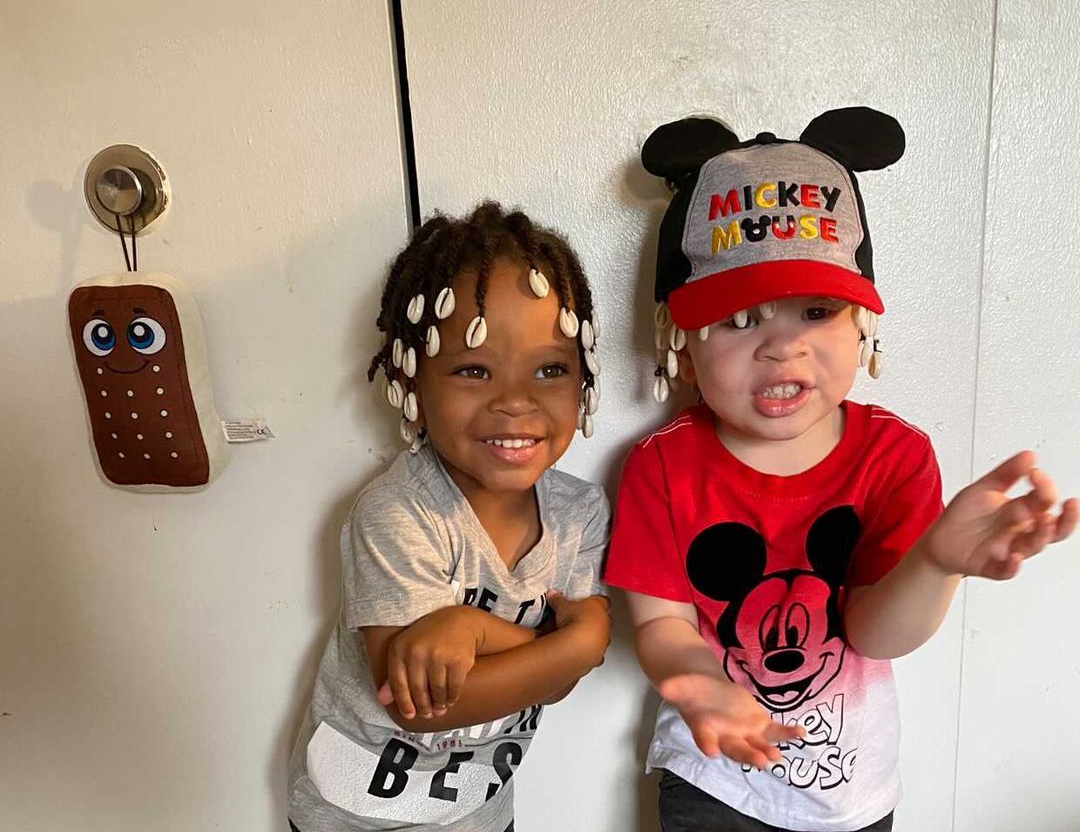 基因遺傳誕下黑白雙胞胎非裔母親：上帝恩賜| 缺陷基因| 白化病| 疾病| 大紀元