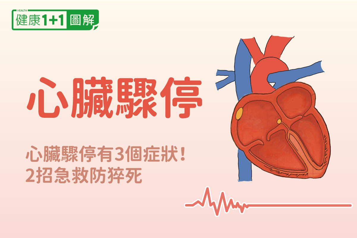 心脏骤停2招急救防猝死 症状 原因和急救方法全图解 Aed Cpr 心律不整 大纪元