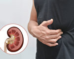 泌尿道结石所引起的绞痛是相当难熬的，大部分的人都是痛在腰部。（Shutterstock／大纪元制图）