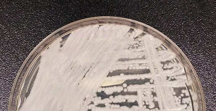 美CDC警告：可致命的耳念珠菌病例激增