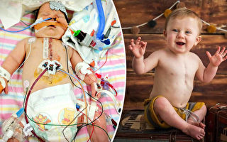 心脏病男婴曾9次被宣布临床死亡 仍笑容灿烂
