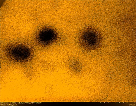圖為研究團隊在電子顯微鏡下取得的肺炎病毒顯微影像。