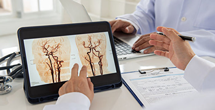 脑卒中成中国人第一大死因 且呈年轻化趋势