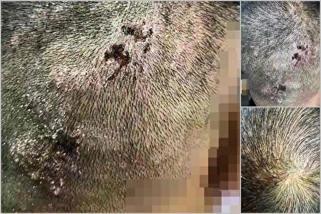 当局强制打疫苗陆民接种身体严重不适 Covid 19 新冠病毒 中共病毒 异常反映 科兴 大纪元