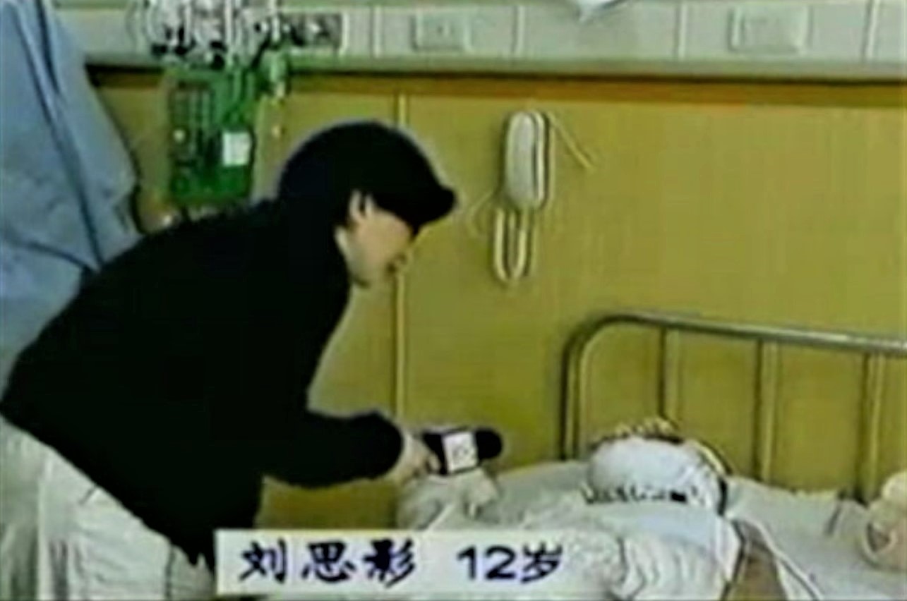 自焚偽案中12歲女孩劉思影被中共當作傀儡使用後滅口。圖為做了氣管切開手術的劉思影卻能在接受央視採訪時唱歌；央視記者李玉強在無菌病房採訪，卻不穿防護服。（明慧網）