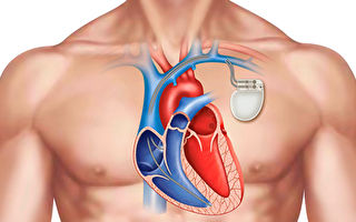 新发明心脏起搏器 不用取出可在体内溶解