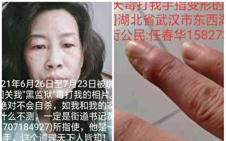 武漢女訪民被關入黑監獄28天 遭電擊虐待