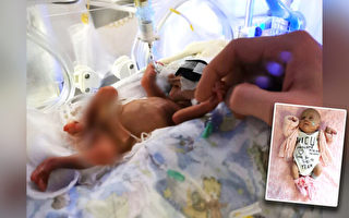 出生時只有1.1磅 蘇格蘭早產兒奇蹟存活