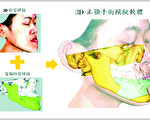 數位醫療的時代 彰基3D正顎手術破百例