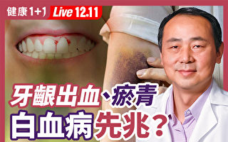 【直播】牙龈出血、瘀青 是白血病先兆？