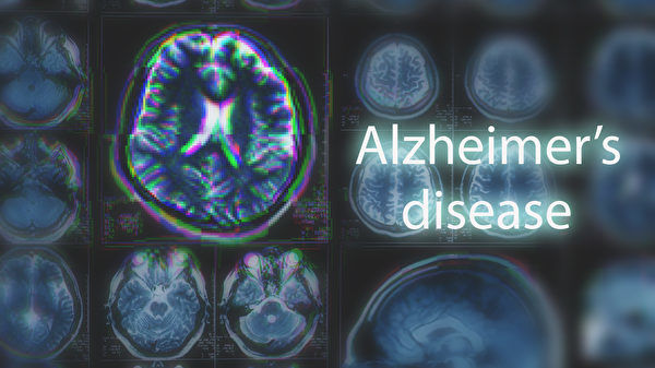 研究发现导致阿兹海默症的深层原因