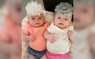 佛州妈妈生出罕见的唐氏症双胞胎 积极面对