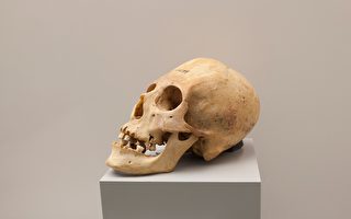 2000年前先进技术 秘鲁头骨嵌入不明金属