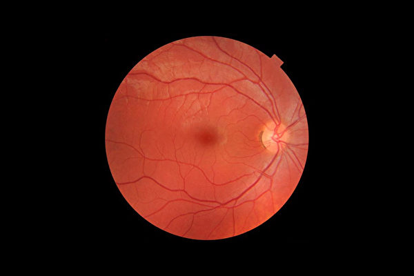 研究发现，视网膜老化程度与未来几年内死亡风险之间有着明显的关联。(Shutterstock)