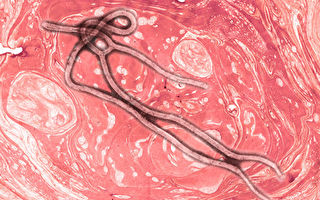 研究：埃博拉病毒可藏腦中 治癒後還會復發