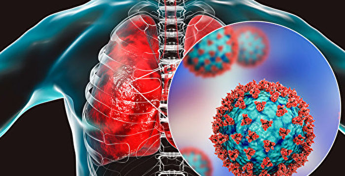 研究：新冠变种病毒藏匿不同器官 难彻底清除