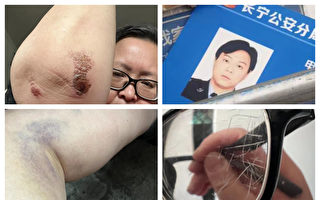 上海女子做核酸咽喉受傷 外出尋醫遭警毆打