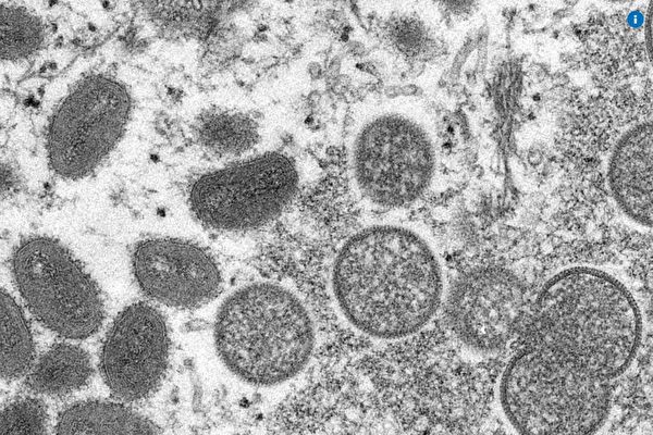 猴痘病毒對哪類人風險更大？美CDC發警告