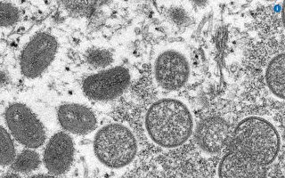 武汉病毒研究所被曝曾做猴痘实验
