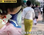 河南商丘儿童集体流鼻血事件 工业污染再被关注
