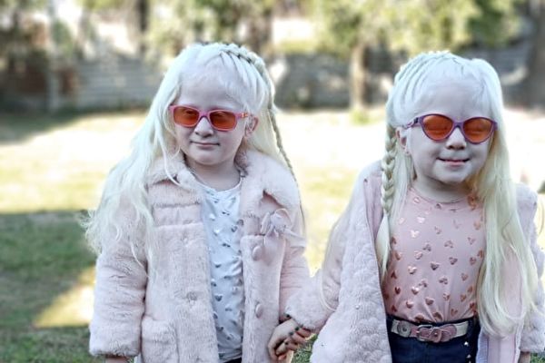阿根廷夫婦誕下罕見白化雙胞胎 但很健康