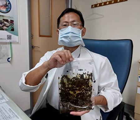 馮啟彥主任表示，郭先生膽結石數量驚人，應是他目前治療過的病人中最多的一位。