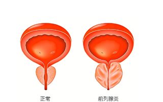 【邓医谈养生】慢性细菌性前列腺炎