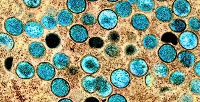 中国猴痘疫情扩散 29天新增逾百例