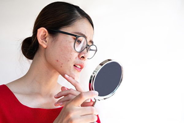 面部痘痘的位置，與不同內臟的健康問題相關。(Shutterstock)