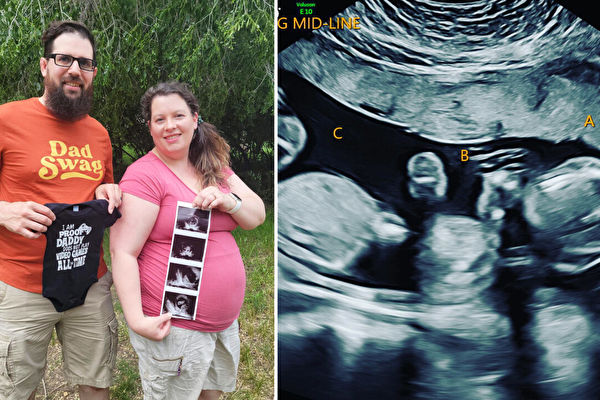 美國夫婦自然受孕 喜獲罕見同卵三胞胎