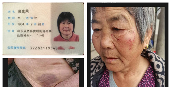 山东临沂老人冤死数月未入土 受伤遗照曝光