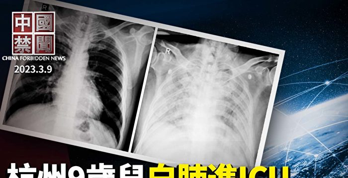 【中国禁闻】杭州九岁儿发烧白肺被送进ICU