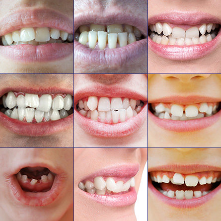 通过矫正牙齿，不仅让笑容更自信，还能改善咬合及牙周健康
