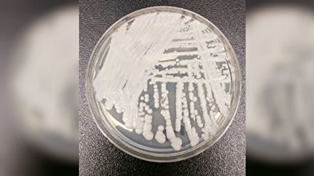 耳念珠菌致病性强 如何从多方面预防感染?
