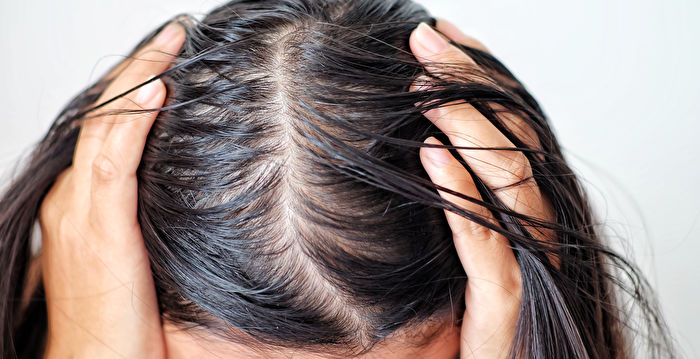 如何对抗头发稀疏？ 专家教你几招
