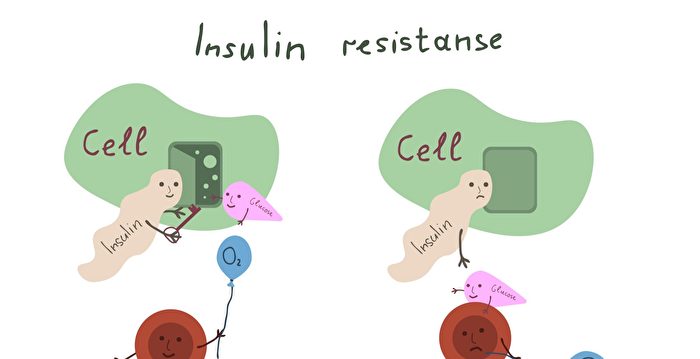 The Invisible Killer: Insulin Resistance and Its Impact on Health