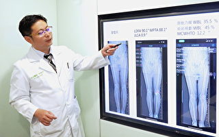 七旬翁雙踝變形困擾生活 3D技術助恢復原功能