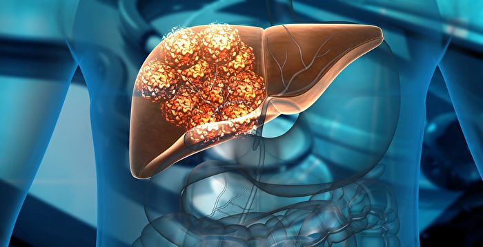 Understanding Liver Cancer: Risk Factors, Diagnosis, and Treatment Options