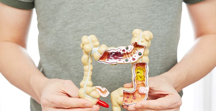 Is colorectal cancer caused by eating?Which foods are good and which are bad | Food elements | White bread