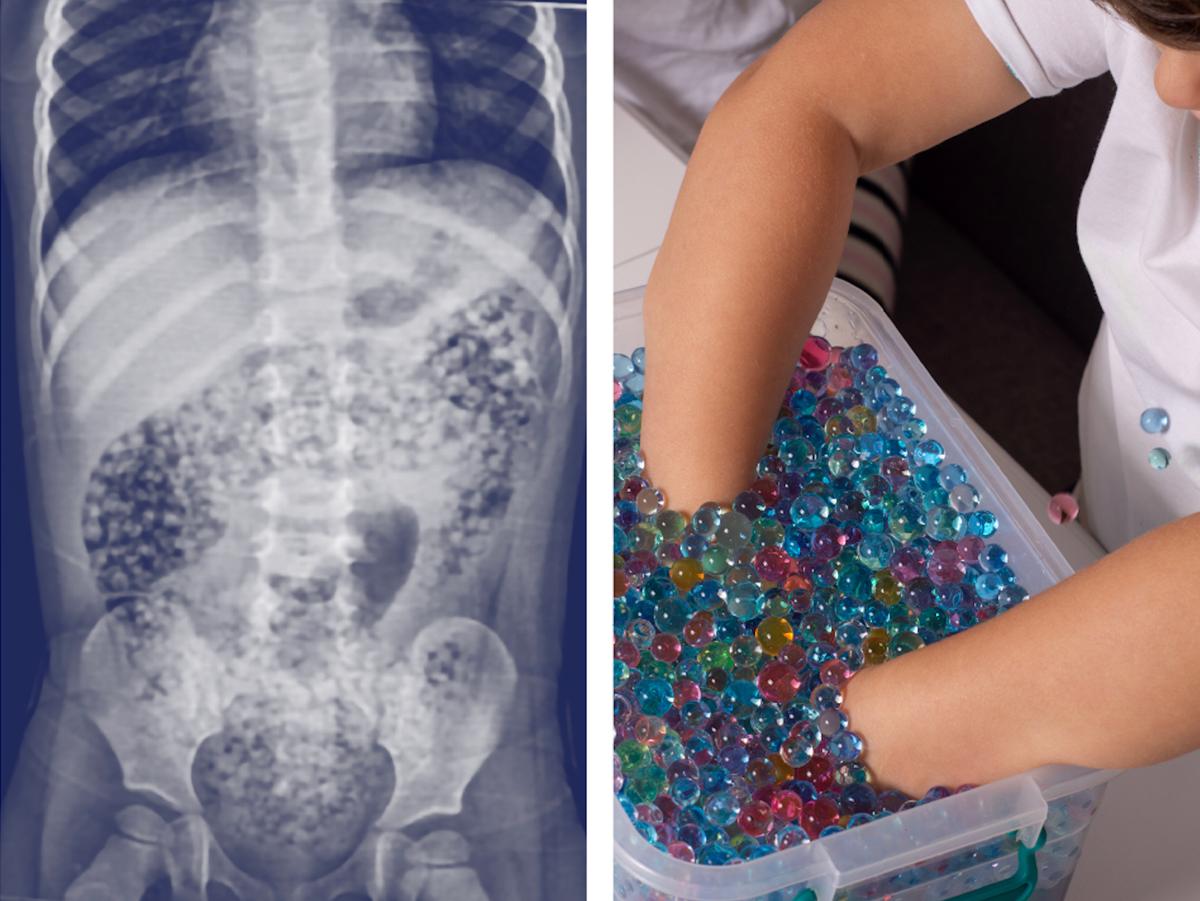 美议员提立法禁止将水珠作为儿童玩具销售| 水晶凝胶| 凝胶珠| 儿童