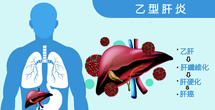 湖南男子未患癌症被切除胆囊化疗致九级伤残